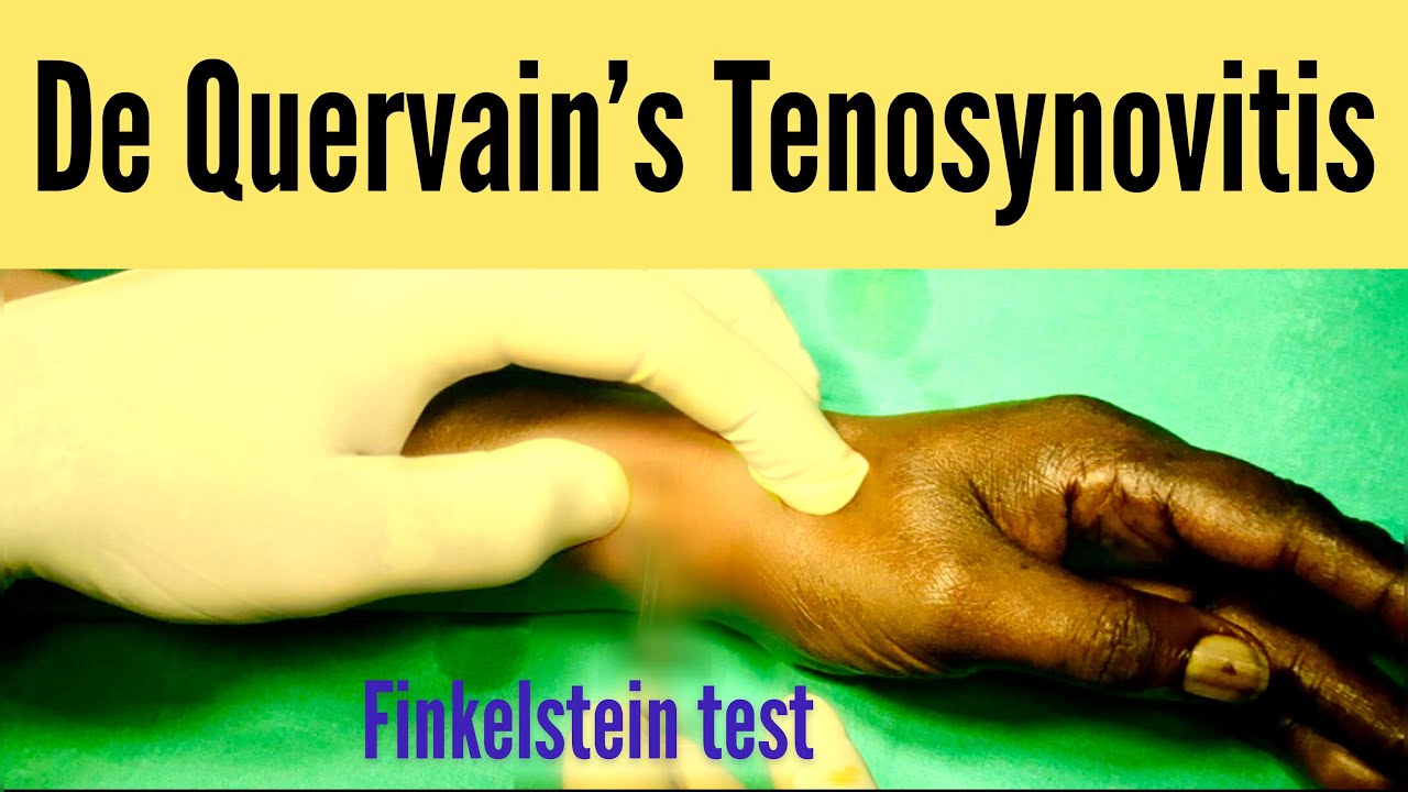De Quervains Tenosynovitis Occupational Therapy Treatment Images