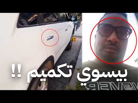 هذا الشخص بيسوي عملية تكميم لسبب جدا غبي
