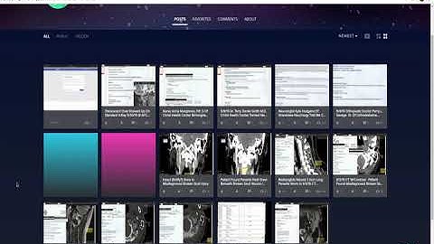 I Was SHADOW BANNED On Imgur For Posting My Medical Records Documenting Misdiagnosed Injury