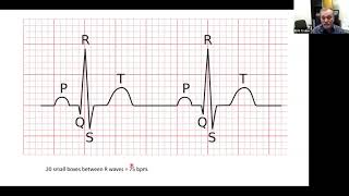Basic interpretation of ECG strips. The 5 step method