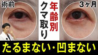 【クマ取り】15症例解説！30〜60代の目の下のたるみ・クマ治療のリアル
