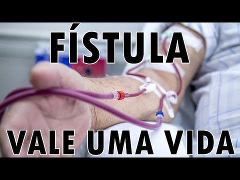 Vídeo: O que é uma fístula av braquiocefálica?