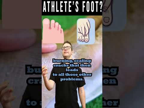 Wideo: Czy grzybica stóp sportowca?