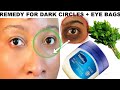 HOW I USE PETROLEUM JELLY AND PARSLEY TO CLEAR DRK CIRCLES, EYE BAGS AND WRINKLES UNDER THE EYES