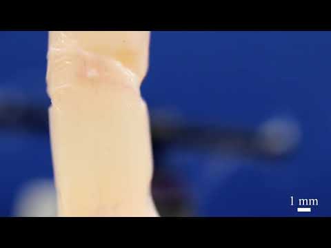 Robotic finger with living human skin