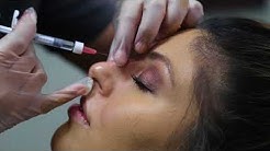 Non-Surgical Rhinoplasty (Nose Job) in San Francisco | Dr. Usha Rajagopal