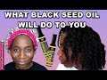 How to Use Black seed Oil for Hair Growth, Beautiful Skin and Health