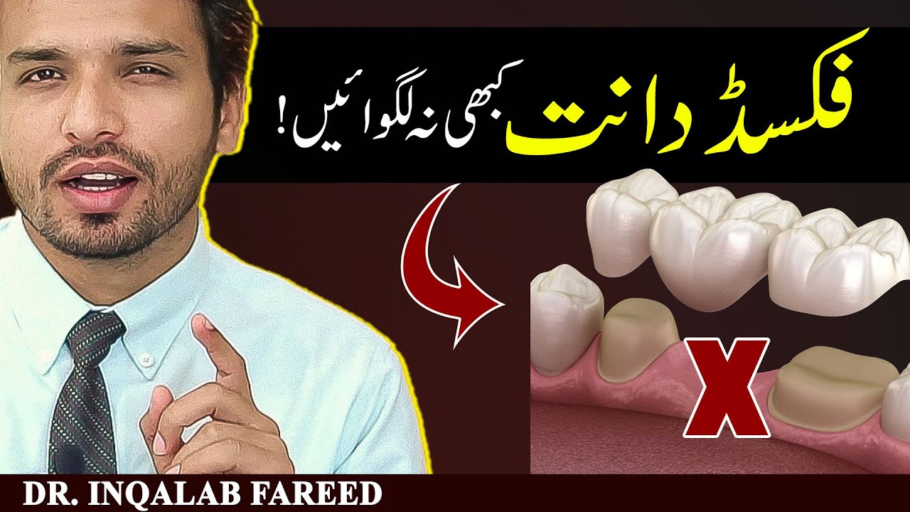 Раскрыты опасности несъемных искусственных зубов! Никогда не ставить мост?