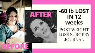 60 lb weight loss in 12 weeks - 3 months rapid weight loss post surgery. Tips and tricks