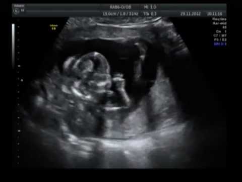 16 недель 3 5. 15-16 Недель беременности. 16 Недель беременности видеоролик УЗИ.