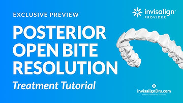 Resolution of a Posterior Open Bite