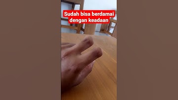 ASLI !!! Penampakan 3 jari tangan putus #shorts #short