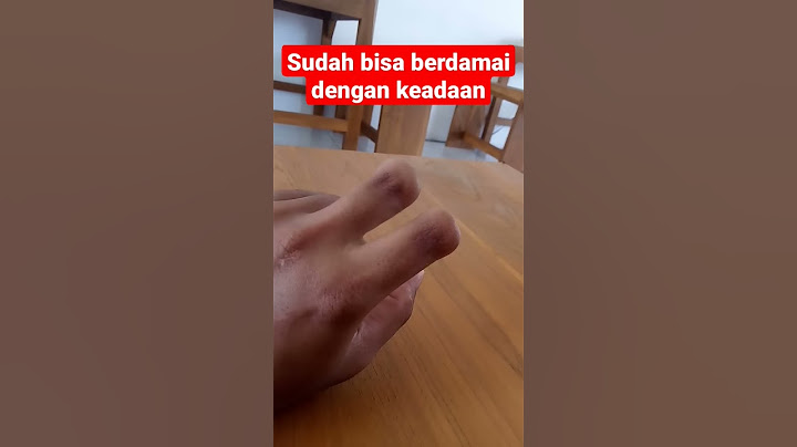 ASLI !!! Penampakan 3 jari tangan putus #shorts #short