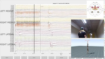 fNIRS signals during motion