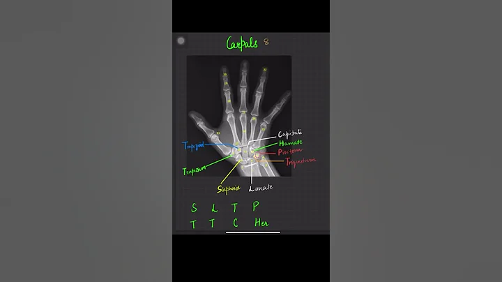 Carpal bone easy Mnemonics Anatomy #anatomy #mnemonic #carpal #bones #fmge  @watsupmed