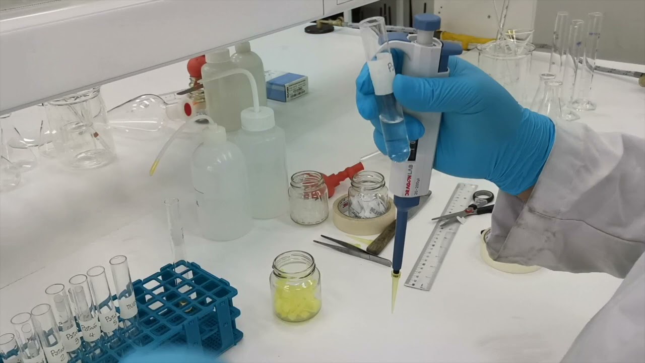 Laboratorio Determinación Glucosa YouTube