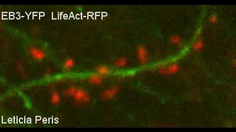 Dynamic microtubule invasion into dendritic spines