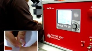 Лазерная сварка кольца | Jewelry Repair | Laser Welding(Лазерная сварка кольца выполняется на аппарате для лазерной сварки BlackLight. Сварка колец производится в..., 2016-04-05T17:45:11.000Z)