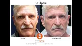 Before & After Cosmetic treatments:Dr. Gidon Frame