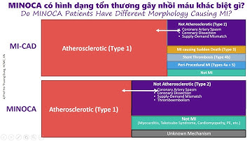 Cập nhật xử trí Nhồi máu cơ tim Không tổn thương ý nghĩa- MINOCA, PGS Hồ Thượng Dũng  JAN 2022