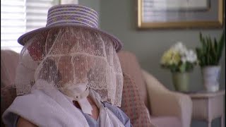 Charla Nash - Nbc News Interview May 2011 Lost Media