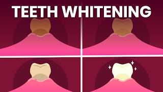 How These Substances Darkens Your Teeth | Teeth Whitening