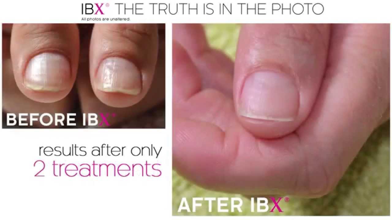 Strengthening IBX nails: instructions, reviews 69 Strengthening IBX nails: instructions, reviews 24