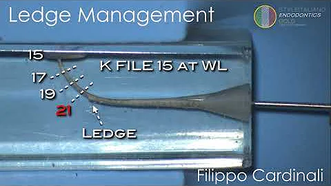 Cardinali - Ledge management 2