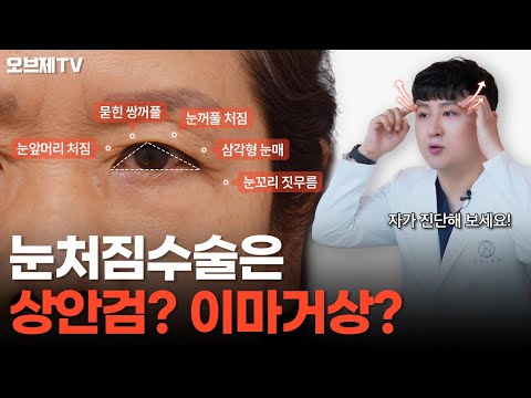 눈처짐수술은 상안검? 이마거상? '중년눈성형' 고민 종결‼️나에게 맞는 수술 초간단 자가진단법 알려드립니다👍 | 오브제성형외과 김현조 원장