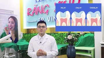 Phương Pháp Phục Hình Inlay - Onlay - Overlay