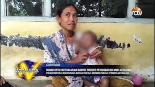 Kuwu Setu Wetan akan Bantu Proses Pengobatan Nur Azzahrah