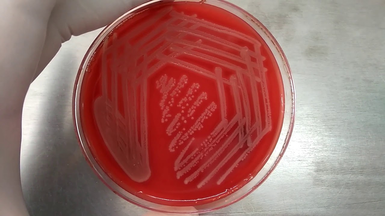 staphylococcus epidermidis streak plate