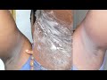 USING BAKING SODA AND LEMON PASTE TO CLEAR MY DARK UNDERARMS | OVERNIGHT MAGIC