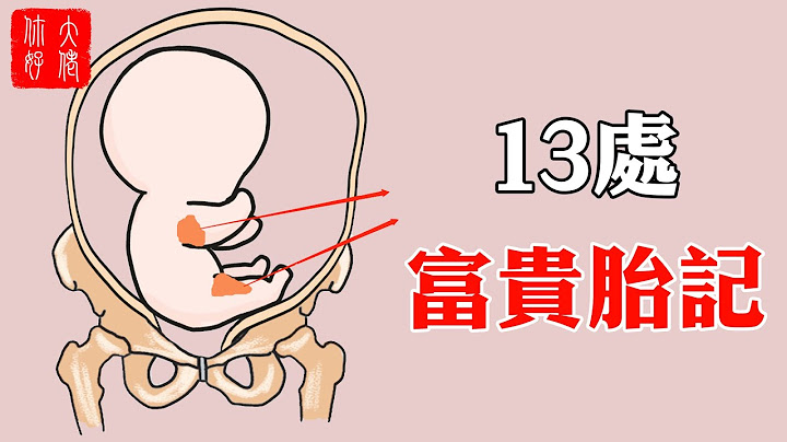 【面相】身上13個胎記，個個富貴多金，快看看你身上有沒有#大佬你好啊 - 天天要聞