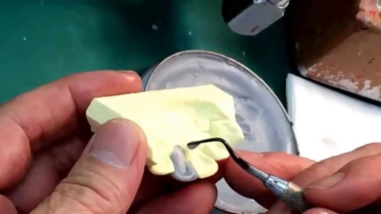 5分でワックスアップデモ(守田先生) ②