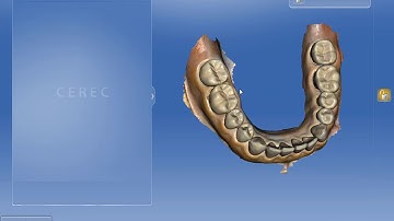 CEREC to STL - How to export digital impressions