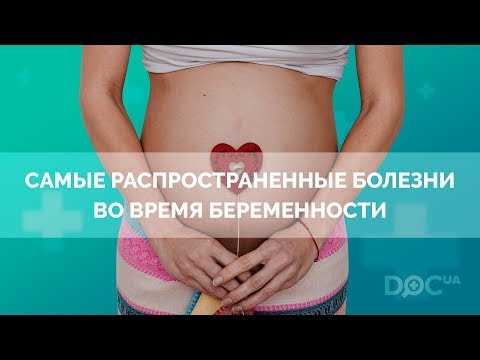 Болезни во время беременности: диагностика беременных и лечение беременных