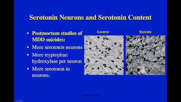 Brain Plasticity: The Effects of Antidepressants on Major Depression