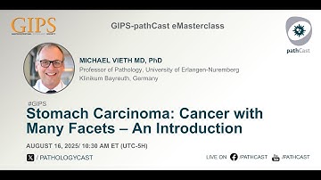 #GIPS Stomach Carcinoma: Cancer with Many Facets  – An Introduction