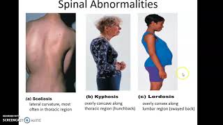 Human Anatomy Chapter 7: The Axial Skeleton Part 2