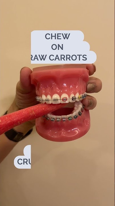 Can you eat carrots with braces