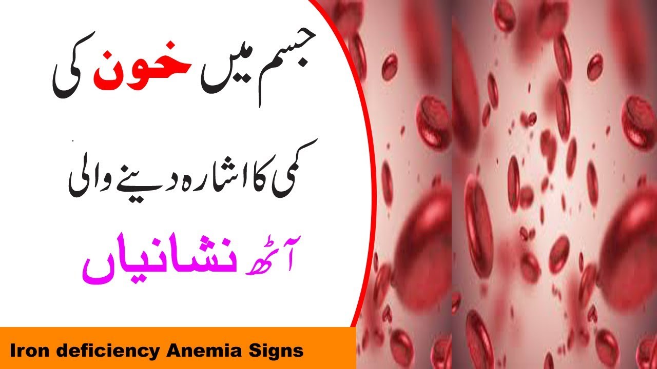 Iron Deficiency Anemia Signs and Symptoms - YouTube