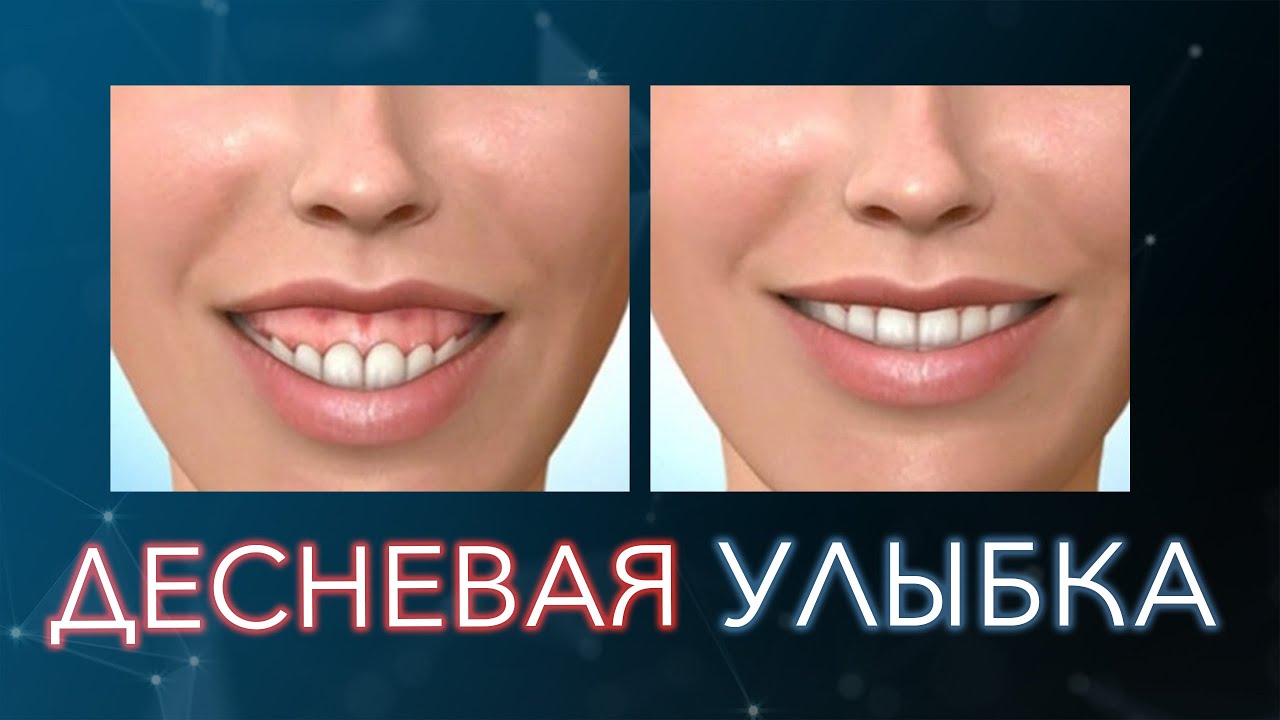 Улыбка машина фото