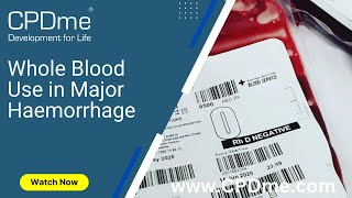 Whole Blood Use in Major Haemorrhage Presented By Prof Jason Smith