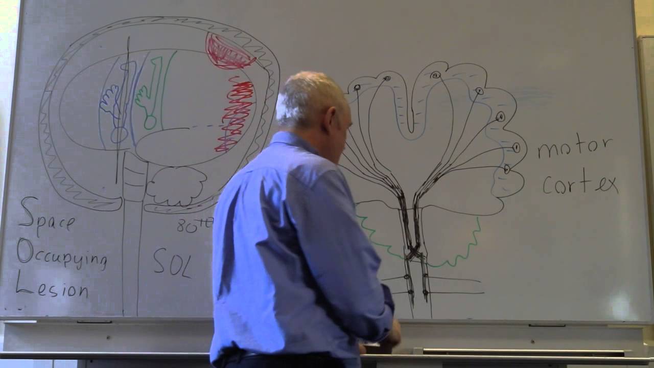 Brain and head injuries lesson 2, Introduction to lateralising signs