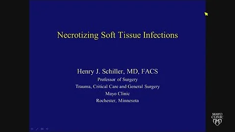 Necrotizing Soft Tissue Infections by Henry Schill...