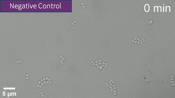 Time lapse video 1 of 2:  S.aureus treated with methanol