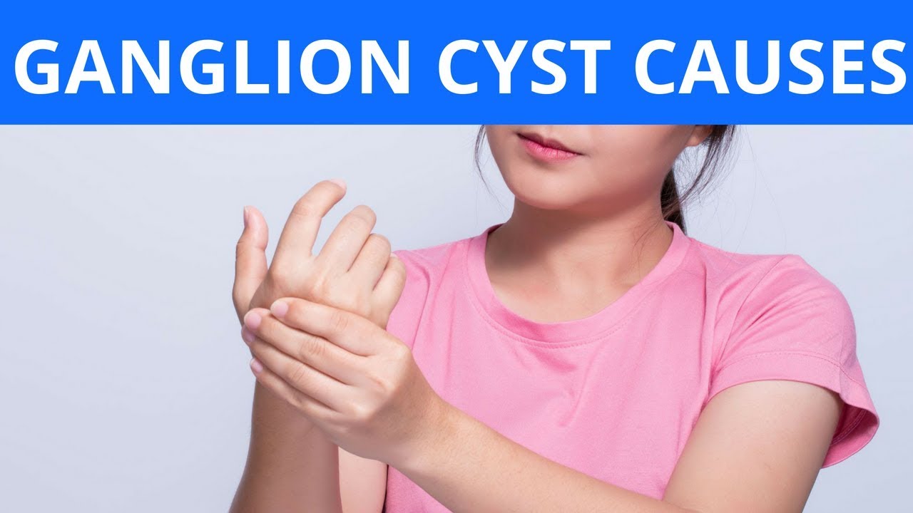 ganglion cyst causes