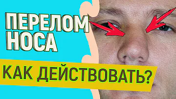 ПЕРЕЛОМ НОСА 👃 Что делать?! 🚩  Как восстановить функциональность и эстетику носа. Ринопластика