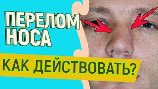 ПЕРЕЛОМ НОСА 👃 Что делать?! 🚩  Как восстановить функциональность и эстетику носа. Ринопластика